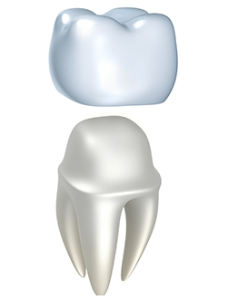 Dental Crowns | Canterra Dental Centre | Downtown Calgary | General and Family Dentist