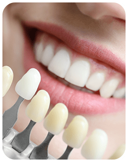 Dental Veneers | Canterra Dental Centre | Downtown Calgary | General and Family Dentist
