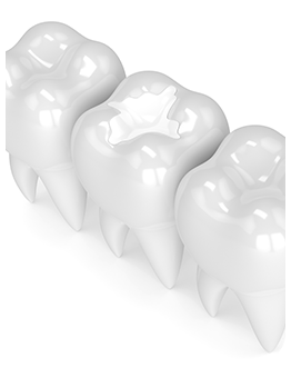 Restorative Dentistry | Canterra Dental Centre | Downtown Calgary | General and Family Dentist