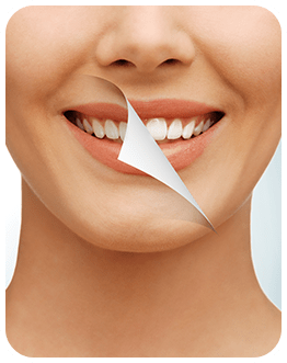 Teeth Whitening | Canterra Dental Centre | Downtown Calgary | General and Family Dentist