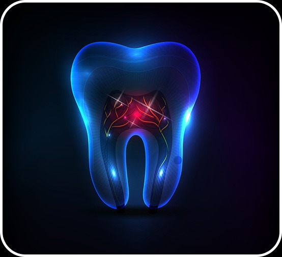 Root Canal Therapy | Canterra Dental Centre | Downtown Calgary | General and Family Dentist